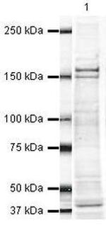 FANCD2 Antibody in Western Blot (WB)
