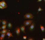 hnRNP A2B1 Polyclonal Antibody