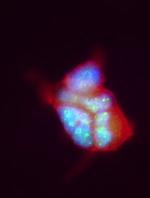 Menin Antibody in Immunocytochemistry (ICC/IF)