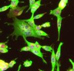 Gephyrin Antibody in Immunocytochemistry (ICC/IF)