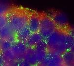 KV1.1 (KCNA1) Antibody in Immunocytochemistry (ICC/IF)