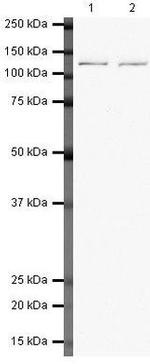 RNF20 Polyclonal Antibody