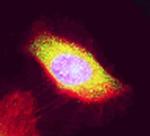 EBP1 Antibody in Immunocytochemistry (ICC/IF)