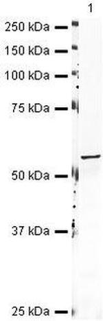 Aromatase Antibody in Western Blot (WB)
