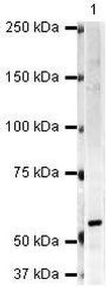Artemis Antibody in Western Blot (WB)