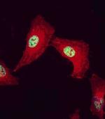 CDK9 Antibody in Immunocytochemistry (ICC/IF)