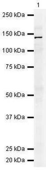 c-Met Antibody in Western Blot (WB)