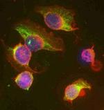 UBE2J1 Antibody in Immunocytochemistry (ICC/IF)