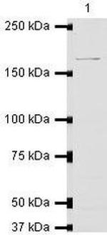 eIF4G3 Antibody in Western Blot (WB)