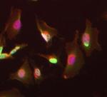 TRBP Antibody in Immunocytochemistry (ICC/IF)