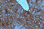 Cofilin Antibody in Immunohistochemistry (IHC)