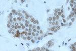 YY1 Antibody in Immunohistochemistry (IHC)