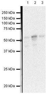 Tryptophan Hydroxylase Antibody in Western Blot (WB)