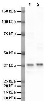 TBP Polyclonal Antibody