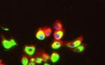 NEFM Antibody in Immunocytochemistry (ICC/IF)