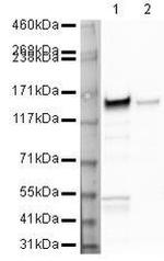 NEFM Antibody in Western Blot (WB)