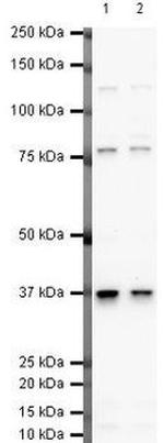 Follistatin Polyclonal Antibody