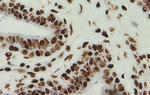 Copeptin Antibody in Immunohistochemistry (IHC)