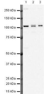 DDX58 Antibody in Western Blot (WB)