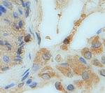 GC Polyclonal Antibody