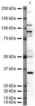 LOX-1 Antibody in Western Blot (WB)