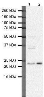 SOCS2 Polyclonal Antibody