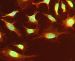 CHD2 Antibody in Immunocytochemistry (ICC/IF)