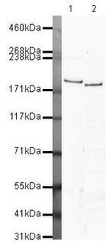 CHD2 Antibody in Western Blot (WB)