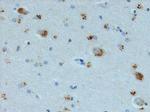 AVP Polyclonal Antibody