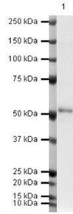 Thymidine Phosphorylase Antibody in Western Blot (WB)