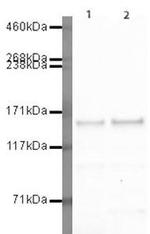 GLI3 Antibody in Western Blot (WB)