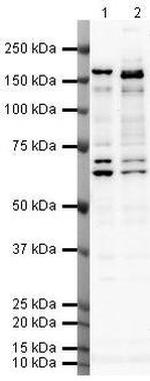 SMARCC2 Polyclonal Antibody