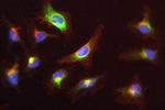 PIK3R1 Antibody in Immunocytochemistry (ICC/IF)