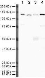 Vinculin Antibody in Western Blot (WB)