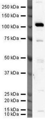 hCV-2 Polyclonal Antibody