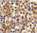 CCR3 Polyclonal Antibody