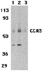 CCR3 Polyclonal Antibody