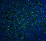 CCR5 Polyclonal Antibody