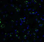 RAIDD Antibody in Immunocytochemistry (ICC/IF)