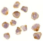 ASK1 Polyclonal Antibody