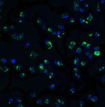 IKK alpha Polyclonal Antibody