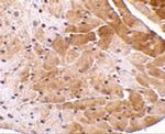 CIDEA Antibody in Immunohistochemistry (IHC)