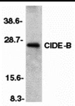 CIDEB Polyclonal Antibody