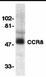 CCR8 Polyclonal Antibody