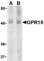 GPR15 Antibody in Western Blot (WB)