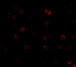 IKK alpha Antibody in Immunocytochemistry (ICC/IF)