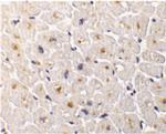 DcR3 Polyclonal Antibody