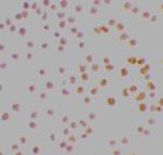 DRAK1 Polyclonal Antibody