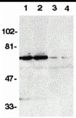 DR6 Polyclonal Antibody