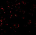 Bcl-10 Polyclonal Antibody